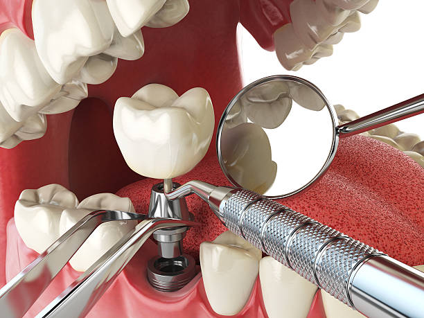 Best Emergency Treatment for Jaw Pain or Injury in West Liberty, IA