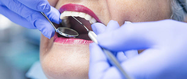 Best Dental Abscess Treatment in West Liberty, IA